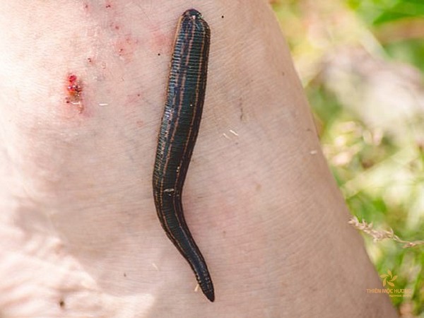 nam-mo-thay-dia-can-1-1 Mơ thấy đĩa đang hút máu