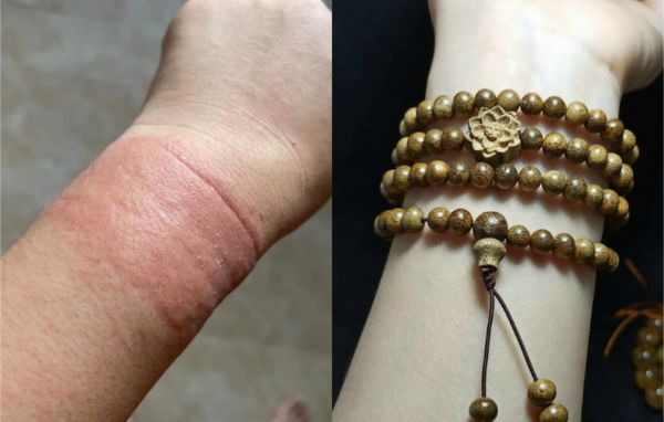 deo-vong-tram-huong-bi-di-ung